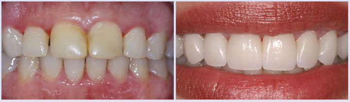 Dental Procedure